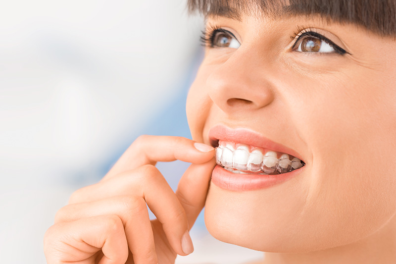 Invisalign in Thousand Oaks